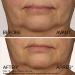 Neutrogena Rapid Firming Peptide Contour Lift Cream - Anti Aging Facial Contour Cream for Firmer looking Skin - 50 grams - Buy Online on GoSupps.com