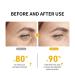 LANBENA Gold Under Eye Mask (30 Pairs) with Retinol & Collagen for Dark Circles and Puffiness - Buy Online on GoSupps.com