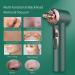 Blackhead Remover Vacuum with Hot Cold Compress | Electric Pore Suction Tool with Light Therapy | Acne Pimple Extractor and Facial Cleanser - Buy Online on GoSupps.com