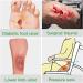 Buy VED Dermapore Adhesive Wound Dressing - Medium 6x7cm | Ideal for Cuts Diabetic Ulcers & Pressure Sores - Pack of 5 - International Shipping Available - Buy Online on GoSupps.com
