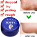 Lintat Hand & Foot Crack Cream | Natural Moisturizer for Dry Skin Heels & Chapped Skin | Anti-Dry Ointment for Int'l Shipping - Buy Online on GoSupps.com