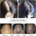 Okeny's Hair Growth Essence Anti-perte De Cheveux Favorisant La Croissance Des Cheveux Vaporisateur pais D'essence - Buy Online on GoSupps.com