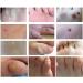 Wart Remover Corn Remover Foot Corn Remover Pads Plantar Wart Removal Corn Callus Remover Penetrates and Removes Common and Plantar Warts Callus Stops Wart Regrowth 20PC - Buy Online on GoSupps.com