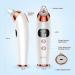 Blackhead Remover Vacuum Pore Cleaner with 5 Suction Power & 5 Probes - Electric USB Rechargeable Extractor for Facial Acne, Whitehead, and Comedone Removal - Includes Hot Compress & 3 Beauty Lamps - Siyaluens Model2 - Buy Online on GoSupps.com