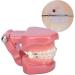 Dytah 1:1 Orthodontic Treatment Teeth Model - Patient Communication & Teaching Tool with Metal & Ceramic Brackets for Adults - Buy Online on GoSupps.com