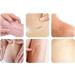 Harayaa Silica Scar Band - 1.5m Painless & Soft Scar Removal Tape for Caesarean Scars - Comfortable & Effective Healing Solution - Buy Online on GoSupps.com