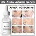 2% Alpha Arbutin + Hyaluronic Acid Facial Serum - Brightening Serum for Dark Spots Fade Acne Scars & Pigmentation - Helps Reduce The Appearance of Melasma & Blemishes - 1 Fl Oz (1) - Buy Online on GoSupps.com