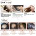 Ginger Germinal Oil Hair Growth Essence Oil Ginger Germinal Essential Oil Hair Loss Treatment Hair Care Hair Growth Serum Promotes Thicker Hair Regrowth For All Hair Types (1PC) - Buy Online on GoSupps.com
