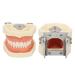 Buy Dental Typodont Teeth Model - 28 Teeth Soft Gums Upper Jaw Cyst Teaching Model for Incision Practice - International Shipping Available - Buy Online on GoSupps.com