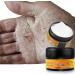 Allbesta Horse Oil Repair Hand Foot Care Exfoliating Cream Anti Frostbite Dry Cracks And Cracks Heal Ointment - Buy Online on GoSupps.com