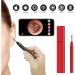 GIENEX Ear Wax Removal Tool with Camera & 6 LED Lights - Red Earwax Removal Kit for Kids, Adults, and Pets - Buy Online on GoSupps.com