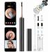 Electric Ear Wax Removal Kit T15 - 2 in 1 Visual Ear Cleaner with HD1080P Endoscope | Magnetic Switch | IP67 Waterproof - Perfect for Acne & Wax Removal - Buy Online on GoSupps.com