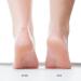 LONDONTOWN Pedikur Foot Scrub - Vegan & Cruelty Free for Smooth Soles & Soft Heels - Buy Online on GoSupps.com