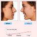 Callypso Nose Shaper Clip | Nose Straightener for Wide Noses | Safe Silicone Design for Effective Results - Buy Online on GoSupps.com
