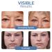 Lovilds & Openeyes Peptide Tight Eye Gel Rejuvenating Eye Lifting Gel for Men & Women (2PCs) Best International Shipping - Buy Online on GoSupps.com