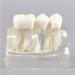 Dental Model Dentist Dental implant Model Resin Material Removable Used for Dental Clinic Research and Doctor-Patient Communication - Buy Online on GoSupps.com