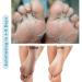 Foot Peel Mask for Smooth Feet - Exfoliating Treatment for Cracked Heels and Calluses - 2 Pack - Buy Online on GoSupps.com