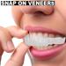 Snap-On Veneers | Comfortable Cosmetic Dental Prosthesis & Flex Dentures for a Perfect Smile - Buy Online on GoSupps.com