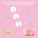 16 Piece Blackhead Remover Comedone Squeezer Set Tweezers Set with Metal Box for Face Defects Suitable for Women and Men for All Skin Types - Buy Online on GoSupps.com