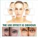 Collagen Face Super Serum Super Serum Hyaluronic Acid Face Super Serum Pro Anti Wrinkle Serum for Women Collagen Booster for Face with Hyaluronic Acid Collagen Peptide Anti Wrinkle Serum - Buy Online on GoSupps.com