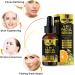 Organic Vitamin C Serum For Face & Hyaluronic Acid. Anti-Aging Wrinkles Dark Spots Brightening Facial Serum With 30% Vitamin C 5% Niacinamide 10% Vitamin E Serum 4 In 1 Vitamin C. - Buy Online on GoSupps.com