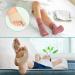 VINGVO Gel Bunion Corrector Toe Straightener - 1 Pair Set for Hallux Valgus Pain Relief - Silicone Separators & Pad - Fleshcolor - Buy Online on GoSupps.com