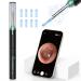 VITCOCO Ear Wax Removal Tool - 1920P HD Ear Cleaner with 6 LED Lights and 8 Ear Spoons  Ear Wax Removal with Camera  Ear Cleaning Kit Compatible for iPhone  iPad  Android Black+blue