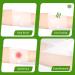 MarvellHealth Hydrogel Burn Dressing 4x4 - Pack of 5 | First Aid for Burns | Cool, Soothing Relief & Pain Protection - Buy Online on GoSupps.com