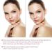 Face Slimming Mask & Neck Support Band - V Face Line Bandages for Weight Loss & Facial Contour | International Shipping - Buy Online on GoSupps.com
