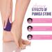 Glamza Foot Pumice Sponge Callus Exfoliate Stone Hard Skin Remove Pedicure Scrubber Pack of 4 - Buy Online on GoSupps.com