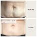 Buy Dermaclara Silicone Stretch Marks Patch Kit - Effective One Patch Solution for Scars | International Shipping Available - Buy Online on GoSupps.com