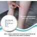 Natural Mosquito Bite Relief Balm for Children | Fast Soothing Anti-Itch | Vitamin E & Essential Oil | Made in UK - 2X15ML - Buy Online on GoSupps.com