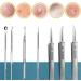 Usiveinborn Blackhead Remover Blackhead Tweezers Facial Blackhead Remover Tweezers Professional Stainless Steel Facial Blackhead Remover Tweezers (8-Piece Set) - Buy Online on GoSupps.com