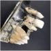 Implant Tooth Template | Oral Simulation Dental Study Model for Teaching - Shop Internationally - Buy Online on GoSupps.com