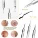 Usiveinborn Blackhead Remover Usiveinborn Tweezers Stainless Steel Facial Blackhead Remover Tweezers Precision Pimple Popper Tool Blackhead Tweezers (3pcs) - Buy Online on GoSupps.com