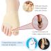 CRTTRS 2Pcs Toe Separator & Bunion Corrector Orthotics for Hallux Valgus - Pedicure Sock Tool - Buy Online on GoSupps.com