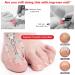 NUNALISA Ingrown Toenail Treatment Kit - Premium Toenail Removal Set with Clippers, File, Pusher, Corrector for Thick & Ingrown Nails - Professional Peticure Tool Included - Buy Online on GoSupps.com