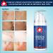 Buy NEW 2023 Advanced Silicone Scar Gel - 100% Medical Grade for Scars Stretch Marks & Acne | Fast International Shipping - Buy Online on GoSupps.com