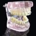 LBYLYH Orthodontic Demonstration Model - Teeth Teaching Tools with Metal & Ceramic Support for Effective Dental Treatment - Buy Online on GoSupps.com