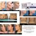 Lipolytic Lipolysis Kit 5 Vials | Permanent Cellulite & Fat Treatment | Skin Tightening | DIY or MedSpa - Buy Online on GoSupps.com