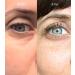 THE HOME FARM EyeGlow Roller Organic Castor Oil Organic Jojoba Oil Organic Frankincense Essential Oil Use as an under eye treatment for dark circles puffiness fine lines & wrinkles. - Buy Online on GoSupps.com
