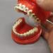 Dental Orthodontic Demonstration Model with Braces | Orthodontic Teeth & Mental Brackets Simulation for Education - Buy Online on GoSupps.com