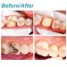 Broken Tooth Repair Kit - Temporary Teeth Replacement for Missing Fillings & Gaps | Improve Your Smile - Buy Online on GoSupps.com