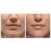 Bielita & Vitex Hyaluron Lift Superlifting Cream-Filler 20ml for Eye and Lips 55+ | Hyaluronic Acid, Black Truffle, Cocoa Seed, Calendula Extract | All Skin Types - Buy Online on GoSupps.com