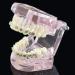 LBYLYH Orthodontic Demonstration Model - Teeth Teaching Tools with Metal & Ceramic Support for Effective Dental Treatment - Buy Online on GoSupps.com