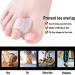 Toe Spreader for Big Toes - Gel Stretcher & Silicone Caps for Hallux Valgus Correction | Pack of 4 - Buy Online on GoSupps.com