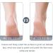 HEALLILY 2PCS Foot Skin Files - Effective Callus Remover & Pedicure Exfoliators for Smooth Feet - International Shipping Available - Buy Online on GoSupps.com