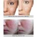 30ml High Dose EGF Serum to Repair Acne & Surgical Scars Wrinkles Burns & Dark Spots - Vegan Microneedling Lifting Anti-Aging Firming Concentrate - Buy Online on GoSupps.com