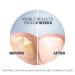 Scholl Fungal Nail Treatment 3.8ml - Effective Nail Fungus Remedy - Buy Online on GoSupps.com