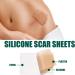Silicone Scar Sheets Roll - 1.6x60inch | Soft Gel Tape for Scar Removal - Medical Grade, Reusable | C Section, Keloid, Surgery, Burn, Acne - Buy Online on GoSupps.com